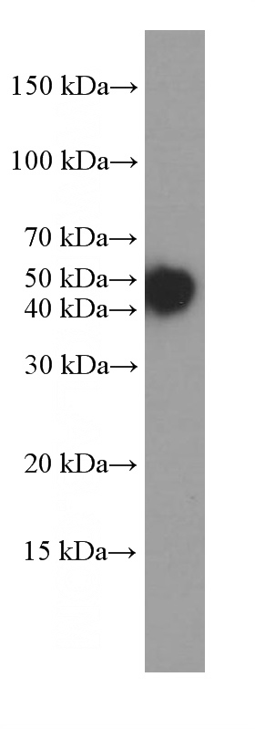 HeLa cells were subjected to SDS PAGE followed by western blot with Catalog No:107231(KRT18 Antibody) at dilution of 1:20000