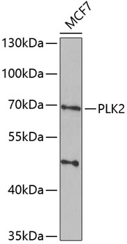 Western blot - PLK2 Polyclonal Antibody 