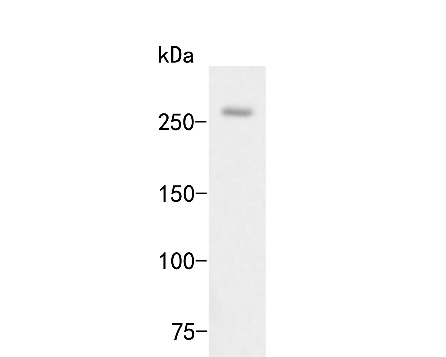 Fig1:; Western blot analysis of Myomegalin on NIH/3T3 cell lysates. Proteins were transferred to a PVDF membrane and blocked with 5% BSA in PBS for 1 hour at room temperature. The primary antibody ( 1/500) was used in 5% BSA at room temperature for 2 hours. Goat Anti-Rabbit IgG - HRP Secondary Antibody (HA1001) at 1:5,000 dilution was used for 1 hour at room temperature.
