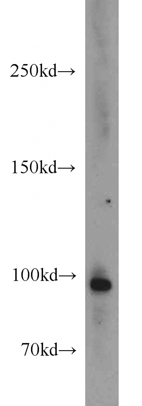 Jurkat cells were subjected to SDS PAGE followed by western blot with Catalog No:116486(TUBGCP3 antibody) at dilution of 1:1000