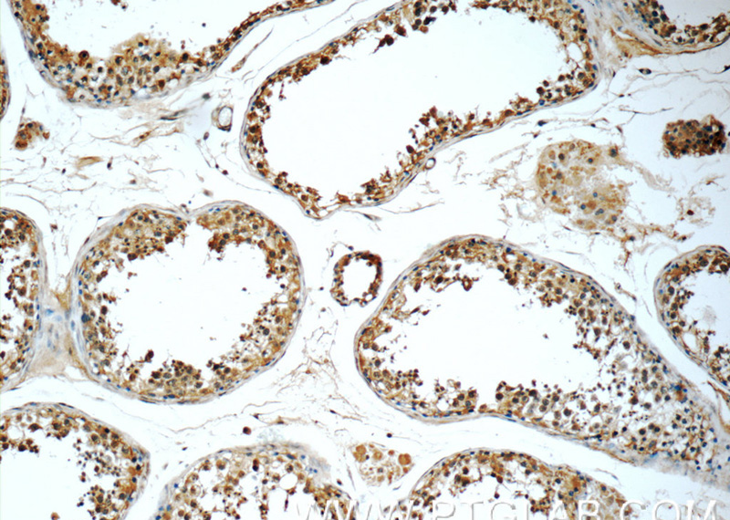 Immunohistochemistry of paraffin-embedded human testis tissue slide using Catalog No:116438(TSNAXIP1 Antibody) at dilution of 1:50 (under 10x lens)