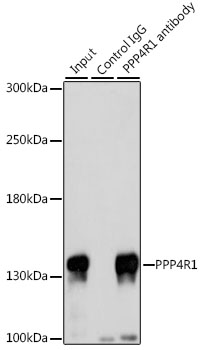 Immunoprecipitation - PPP4R1 Polyclonal Antibody 