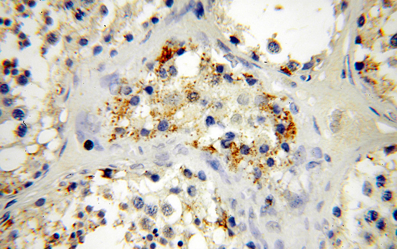 Immunohistochemical of paraffin-embedded human testis using Catalog No:109677(CYLC2 antibody) at dilution of 1:100 (under 40x lens)