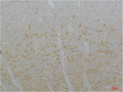Fig1:; Immunohistochemical analysis of paraffin-embedded Rat Brain Tissue using Cav3.3Rabbit pAb diluted at 1:200.