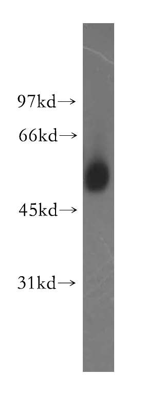 human brain tissue were subjected to SDS PAGE followed by western blot with Catalog No:116426(TSEN2 antibody) at dilution of 1:400