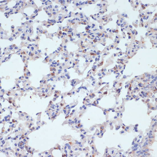 Immunohistochemistry - SFTPC Polyclonal Antibody 