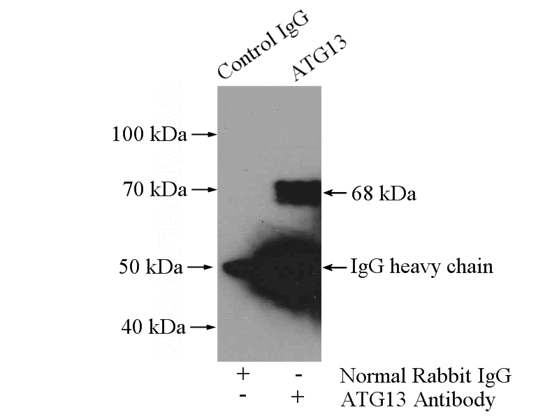 IP Result of anti-KIAA0652 (IP:Catalog No:108290, 4ug; Detection:Catalog No:108290 1:300) with SH-SY5Y cells lysate 1600ug.