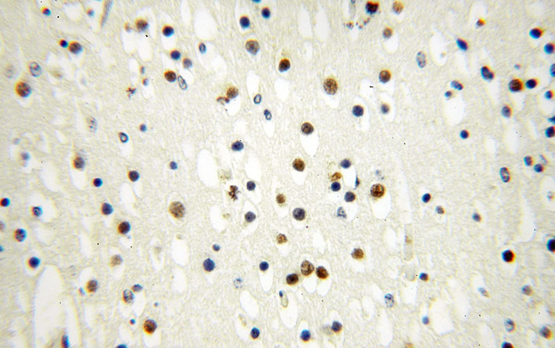 Immunohistochemical of paraffin-embedded human brain using Catalog No:111809(INTS7 antibody) at dilution of 1:100 (under 40x lens)