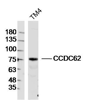 Fig1: Sample:TM4(Mouse)Cell Lysate at 40 ug; Primary: Anti-CCDC62 at 1/300 dilution; Secondary: IRDye800CW Goat Anti-Rabbit IgG at 1/20000 dilution; Predicted band size: 78 kD; Observed band size: 78 kD