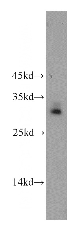 mouse testis tissue were subjected to SDS PAGE followed by western blot with Catalog No:108643(C11orf70 antibody) at dilution of 1:400