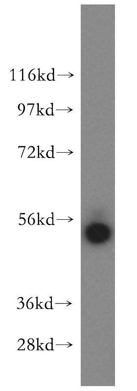 mouse kidney tissue were subjected to SDS PAGE followed by western blot with Catalog No:110729(FMO2-specific antibody) at dilution of 1:300