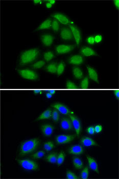 Immunofluorescence - ELAC2 Polyclonal Antibody 