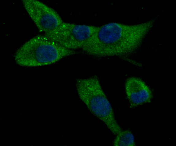 Fig4: ICC staining CACNG5 in PANC-1 cells (green). The nuclear counter stain is DAPI (blue). Cells were fixed in paraformaldehyde, permeabilised with 0.25% Triton X100/PBS.