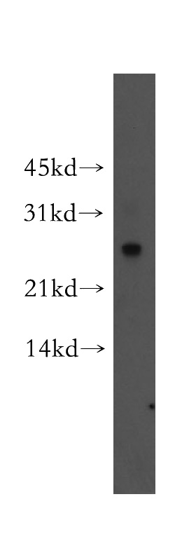 human brain tissue were subjected to SDS PAGE followed by western blot with Catalog No:109451(Connexin-26 antibody) at dilution of 1:300