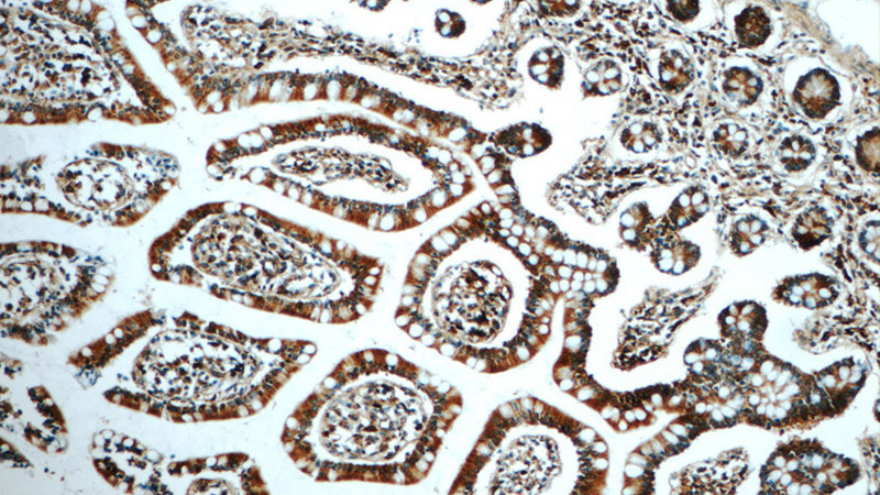 Immunohistochemistry of paraffin-embedded human small intestine tissue slide using Catalog No:111817(PLA2G6 Antibody) at dilution of 1:50 (under 10x lens)
