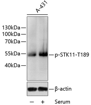 Western blot - Phospho-STK11-T189 pAb 
