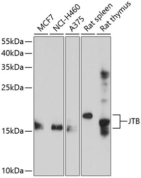 Western blot - JTB Polyclonal Antibody 