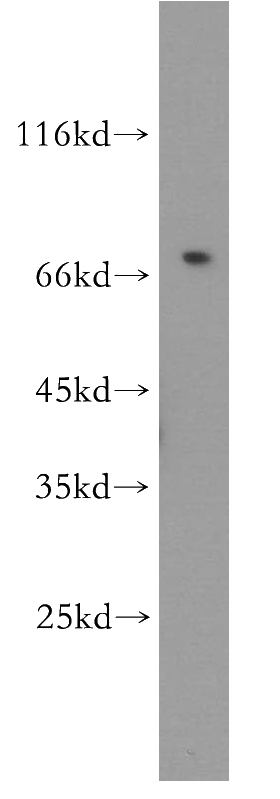 HeLa cells were subjected to SDS PAGE followed by western blot with Catalog No:111116(GPR161 antibody) at dilution of 1:500