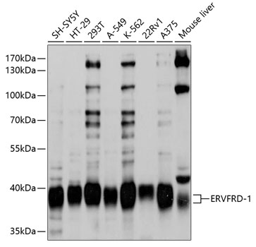 Western blot - ERVFRD-1 Polyclonal Antibody 