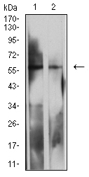 Fig3: Western blot analysis of 175073# against MOLT4 (1) and K562 (2) cell lysate.Proteins were transferred to a PVDF membrane and blocked with 5% BSA in PBS for 1 hour at room temperature. The primary antibody ( 1/500) was used in 5% BSA at room temperature for 2 hours. Goat Anti-Mouse IgG - HRP Secondary Antibody at 1:5,000 dilution was used for 1 hour at room temperature.