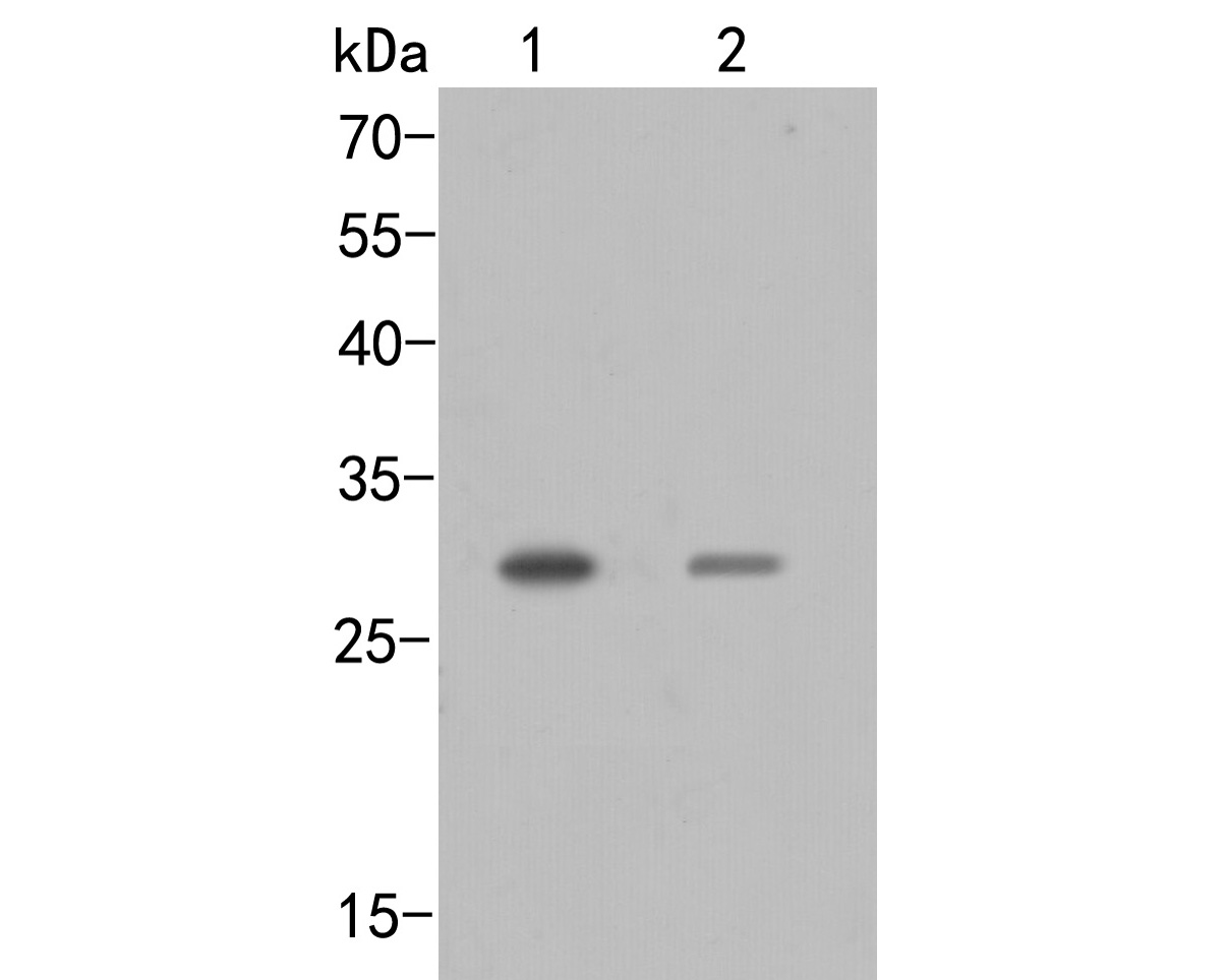 Fig1:; Western blot analysis of SIX2 on different lysates. Proteins were transferred to a PVDF membrane and blocked with 5% BSA in PBS for 1 hour at room temperature. The primary antibody ( 1/500) was used in 5% BSA at room temperature for 2 hours. Goat Anti-Rabbit IgG - HRP Secondary Antibody (HA1001) at 1:5,000 dilution was used for 1 hour at room temperature.; Positive control:; Lane 1: Mouse kidney tissue lysate; Lane 2: Mouse stomach tissue lysate