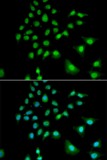 Immunofluorescence - UBE3C Polyclonal Antibody 