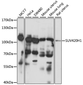 Western blot - SUV420H1 Polyclonal Antibody 