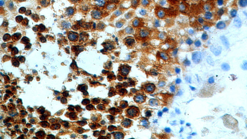 Immunohistochemical of paraffin-embedded human testis using Catalog No:108817(CALCocO1 antibody) at dilution of 1:100 (under 40x lens)