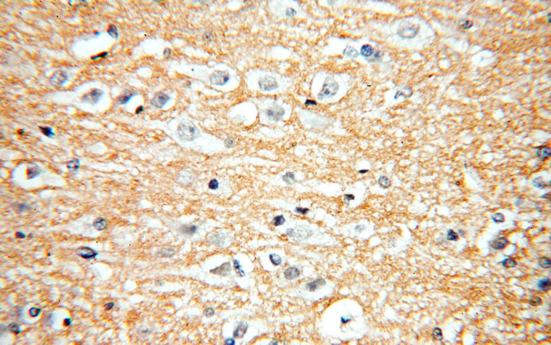 Immunohistochemical of paraffin-embedded human brain using Catalog No:114504(RAC1/2/3 antibody) at dilution of 1:100 (under 40x lens)