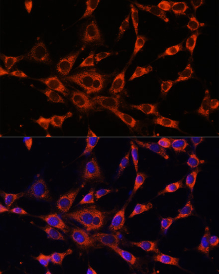 Immunofluorescence - ITPR3 Polyclonal Antibody 