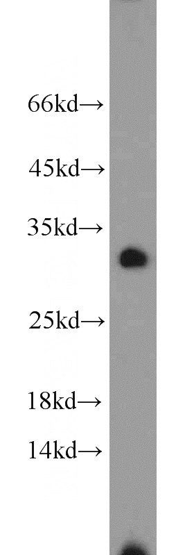 HeLa cells were subjected to SDS PAGE followed by western blot with Catalog No:113292(NOL12 antibody) at dilution of 1:1000