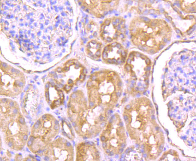 Fig4: Immunohistochemical analysis of paraffin-embedded human kidney tissue using anti-NaV1.7 antibody. Counter stained with hematoxylin.