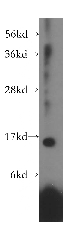 HeLa cells were subjected to SDS PAGE followed by western blot with Catalog No:114885(RPL28 antibody) at dilution of 1:1000