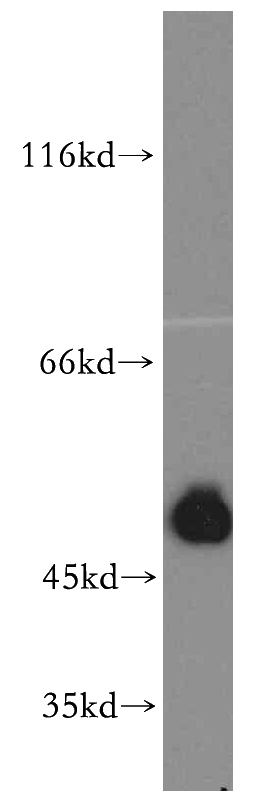 HT-1080 cells were subjected to SDS PAGE followed by western blot with Catalog No:115387(SMCR7L antibody) at dilution of 1:400