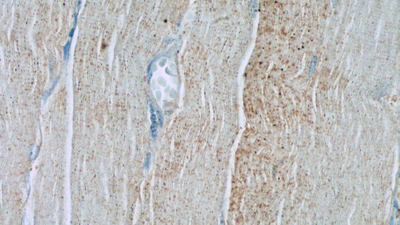 Immunohistochemistry of paraffin-embedded human skeletal muscle tissue slide using Catalog No:111079(GLUT4 Antibody) at dilution of 1:50 (under 40x lens)