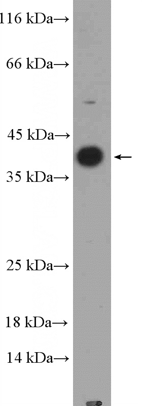 A431 cells were subjected to SDS PAGE followed by western blot with Catalog No:111653(IL1B Antibody) at dilution of 1:300