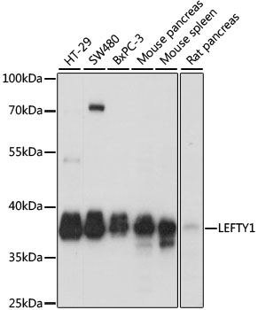 Western blot - LEFTY1 Polyclonal Antibody 