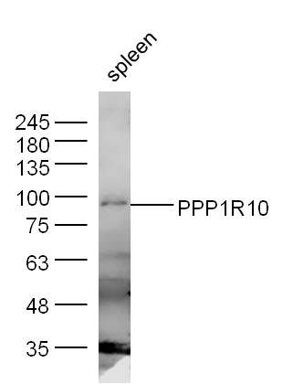 Fig1: Sample:; Spleen (Mouse) Lysate at 40 ug; Primary: Anti-PPP1R10 (Bs- 11666R) at 1/300 dilution; Secondary: IRDye800CW Goat Anti-Rabbit IgG at 1/20000 dilution; Predicted band size: 99 kD; Observed band size: 99 kD