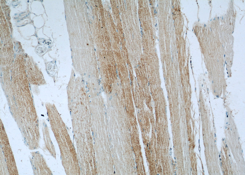 Immunohistochemistry of paraffin-embedded human skeletal muscle slide using Catalog No:111932(IRGQ Antibody) at dilution of 1:50 (under 10x lens)