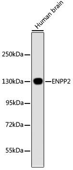 Western blot - ENPP2 Polyclonal Antibody 
