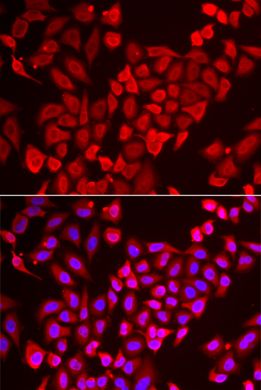 Immunofluorescence - TNP2 Polyclonal Antibody 