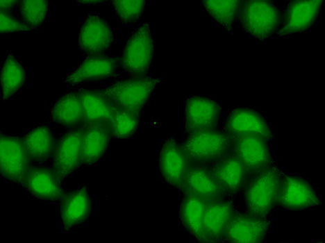 Immunofluorescence - SS18 Polyclonal Antibody 