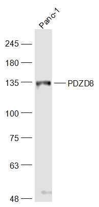 Fig3: Sample:; Panc-1(Human) Cell Lysate at 30 ug; Primary: Anti-PDZD8 at 1/1000 dilution; Secondary: IRDye800CW Goat Anti-Rabbit IgG at 1/20000 dilution; Predicted band size: 128 kD; Observed band size: 130kD