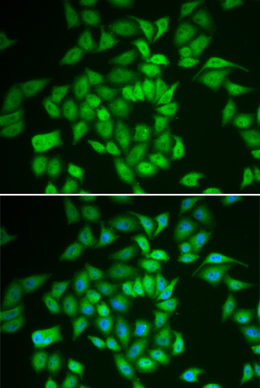 Immunofluorescence - CSNK1E Polyclonal Antibody 