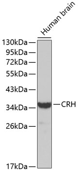 Western blot - CRH Polyclonal Antibody 