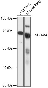 Western blot - SLC6A4 Polyclonal Antibody 