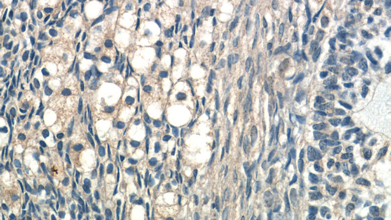 Immunohistochemistry of paraffin-embedded human ovary tissue slide using Catalog No:110583(FAM20A Antibody) at dilution of 1:50 (under 40x lens)