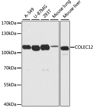 Western blot - COLEC12 Polyclonal Antibody 