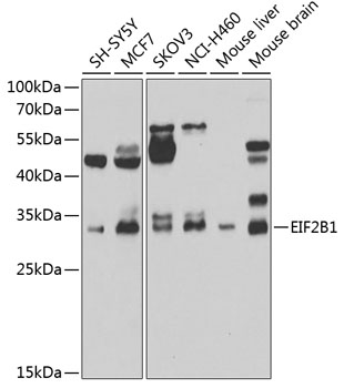 Western blot - EIF2B1 Polyclonal Antibody 