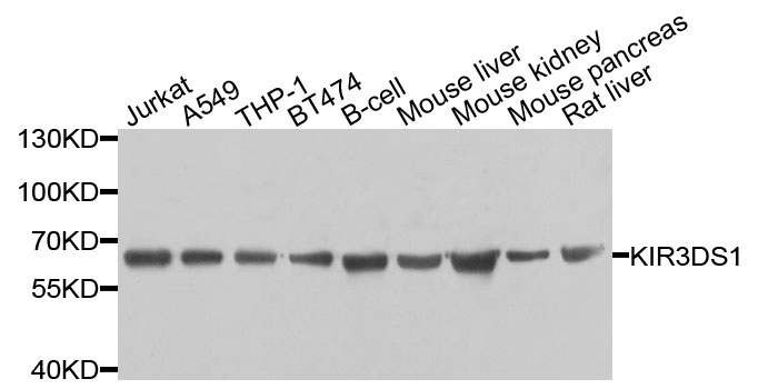Western blot - KIR3DS1 Polyclonal Antibody 